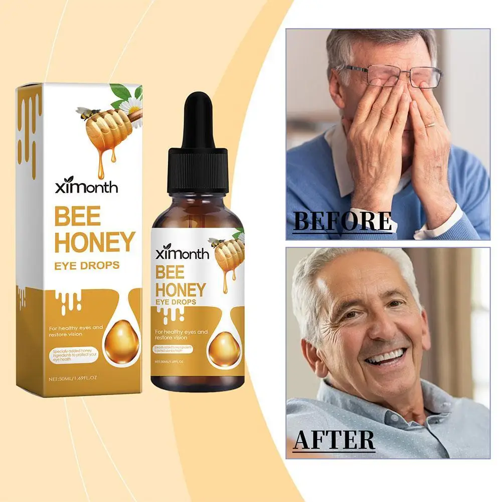 50ml Bee Honey Eye Drops Eye Treatment Discomfort Drops For Blurred Vision Cure Dry Eyes Cloudy Eyeball Black Shadow Remover