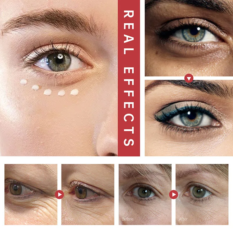 Multi Balm Volume Calcium, корейский крем для ухода за кожей, крем для лица и глаз, коллаген, глубоко увлажняющий, против морщин, подходит для предварительного макияжа