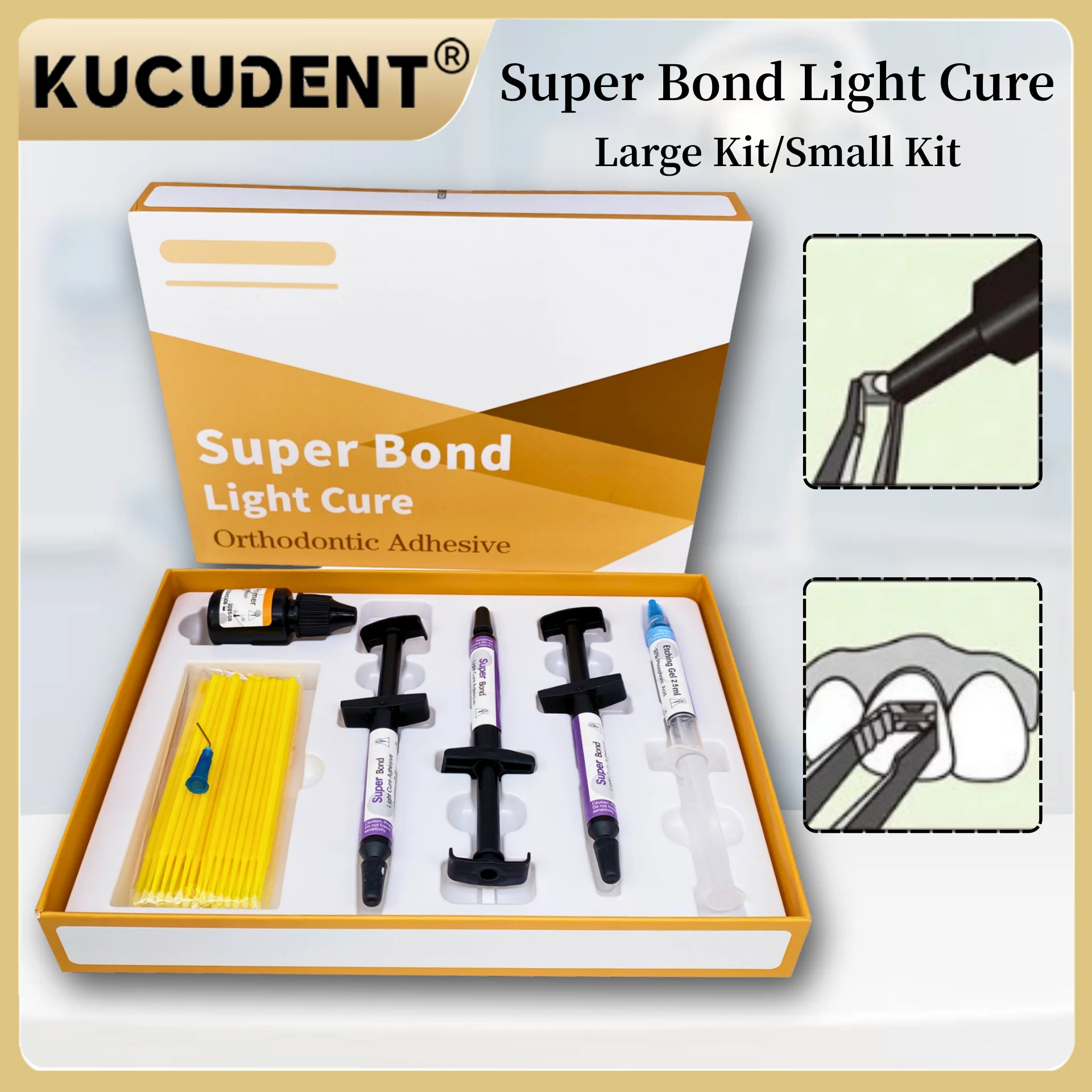 1 Set Professional Orthodontic Bonding System - Light-Cure Adhesive Kit for Direct Brackets & Buccal Tube Attachment