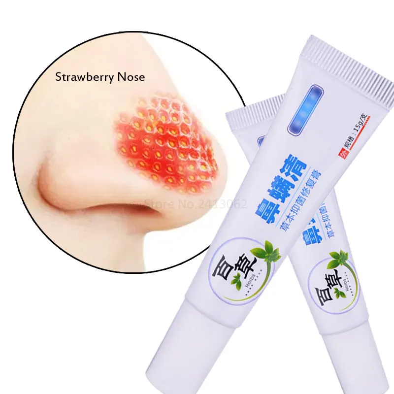 

Herbal Anti Nose Mites Remove Acne Rosacea Cream Red Nose Blackhead Remover Acne Treatment Shrink Pores Face Bleaching Ointment