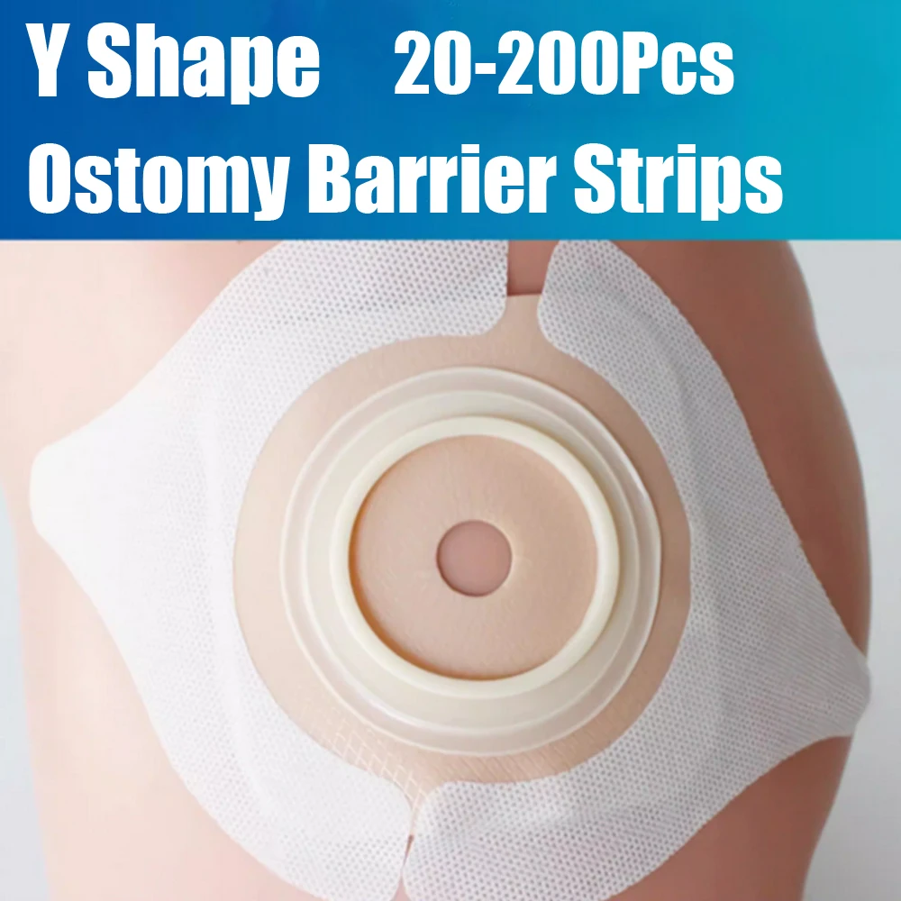 20-200Pcs Ostomy Barrier Strips Y Shape Adhesive Seal Extender Strip For Colostomy Bags Ileostomy Tape For Stoma Ostomy Bag