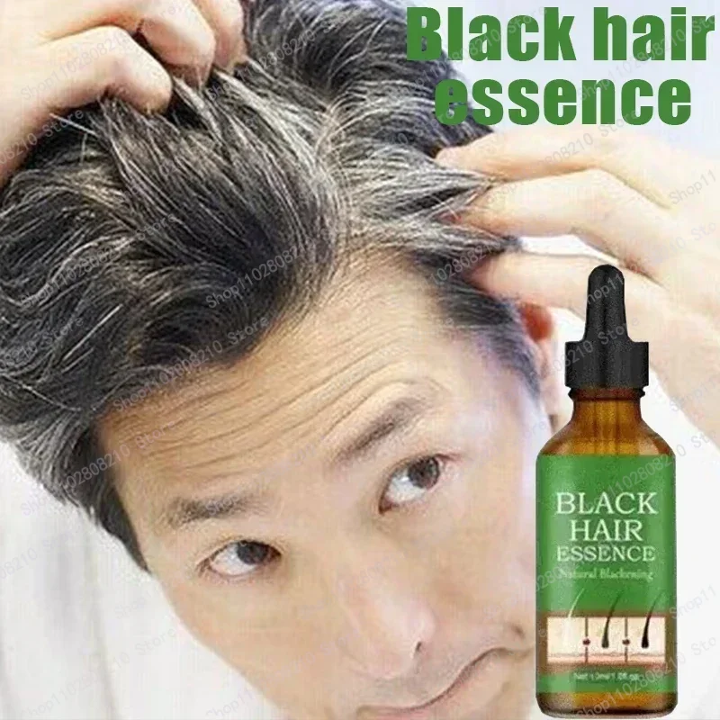 Health with Anti-Grey Hair Essence Serum Treatment Revitalize Your Ahair Essence Serum Treatment Restore Natural Hairand 23 0903