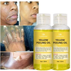 Weiß Serum gelb Bleichen Peeling Peeling abgestorbene Hautpflege öl dunkle Haut entfernen Arm Knie Beine Melanin Körper aufhellen Peeling