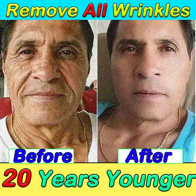

OUHOE Anti-wrinkle Oxys Cream Wrinkle Face Cream Anti Aging Face Lift Facial Massagers Facial Lifting Beauty Health Skin Cream
