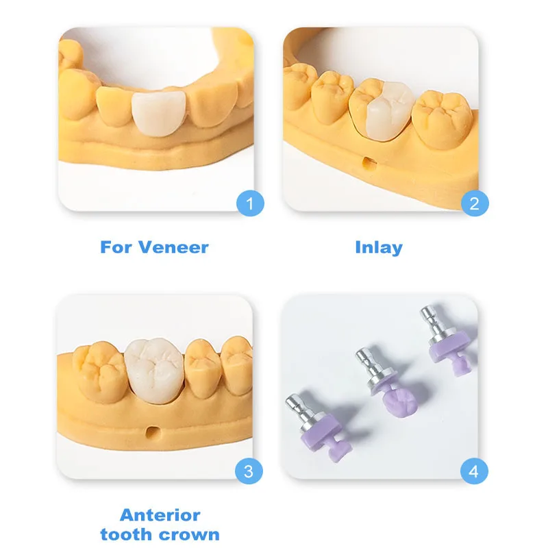 RACHCERA-كتلة ديسيليكات الليثيوم لقشور التاج ، سبائك السيراميك ، Emax الأسنان ، HT ، LT ، A1-D4 ، CAD ، CAM ، اضغط ، 10 قطعة