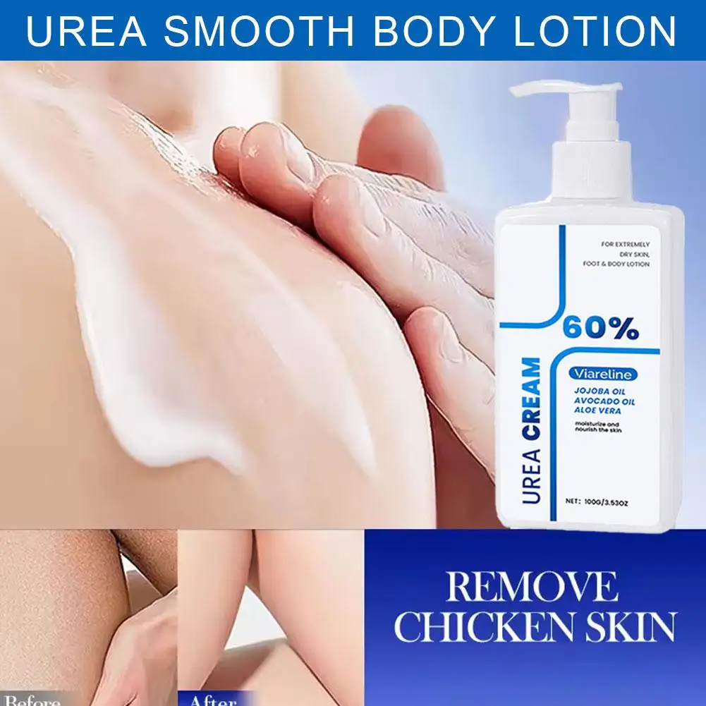 Urea Body Lotion - Gently Hydrates And Moisturizes Dry Body Skin, Delivers Comfort, Ideal For Daily Full-Body Care P9P0