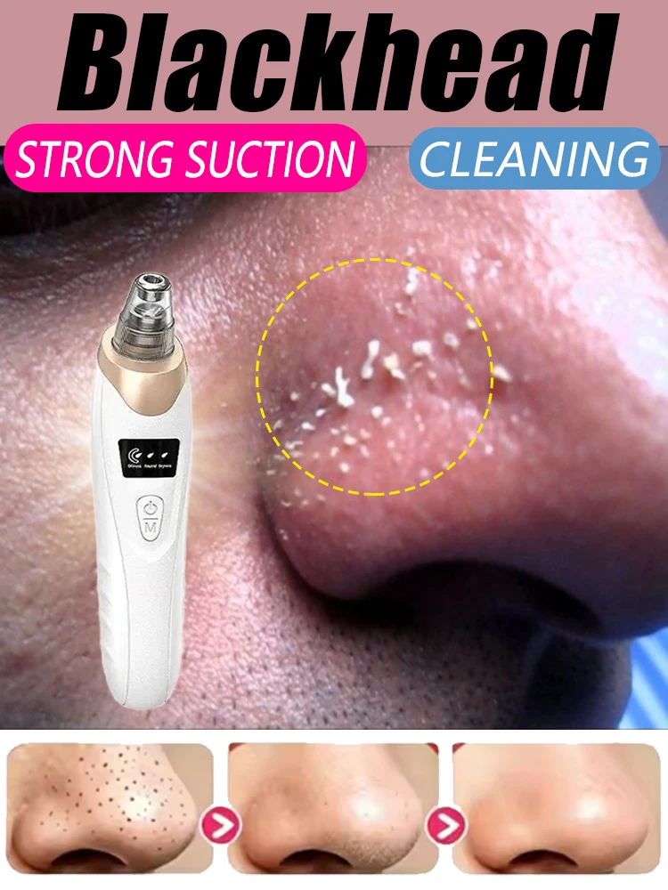 

2026Cordless Facial Suction Beauty Tool with Adjustable Levels, Professional Pore Cleansing for Excess Sebum & Comedone Removal.