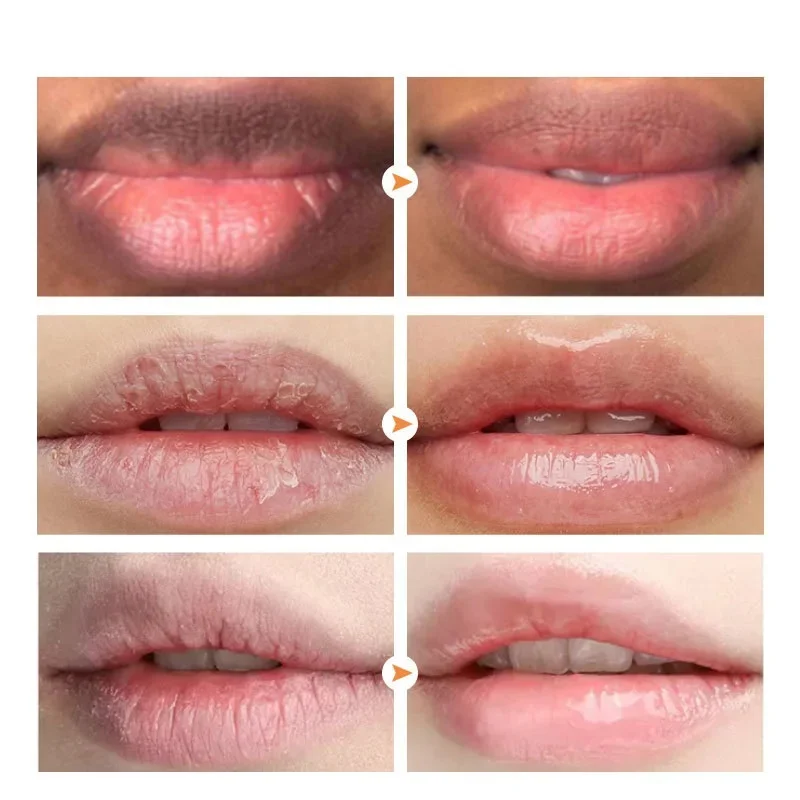 Remove Dark Lip Balm Fast Lighten Melanin Mask Gloss Oil Exfoliate Pink Lip Reduce Lip Lines Moisturizer Dead Skin Repair Care