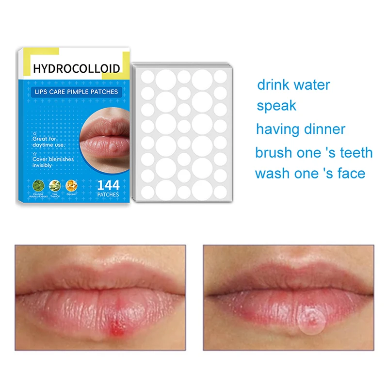 144pcs Mouth Blister Patch Cold Sore Lip Blister Patch Cold Sore Healing Hydrocolloid Lip Care Stickers Mouth Blister Patch