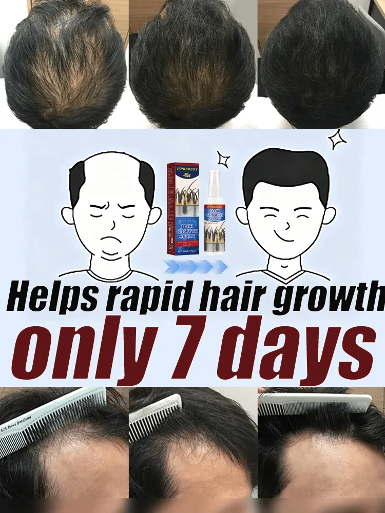 Wᴏʀʀɪᴇᴅ ᴀʙᴏᴜᴛ ʜᴀɪʀ ʟᴏss? Nᴇᴡ ʜᴀɪʀ ɢʀᴏᴡᴛʜ sᴘʀᴀʏ ғᴏʀ ᴛʜɪᴄᴋᴇʀ ʜᴀɪʀ