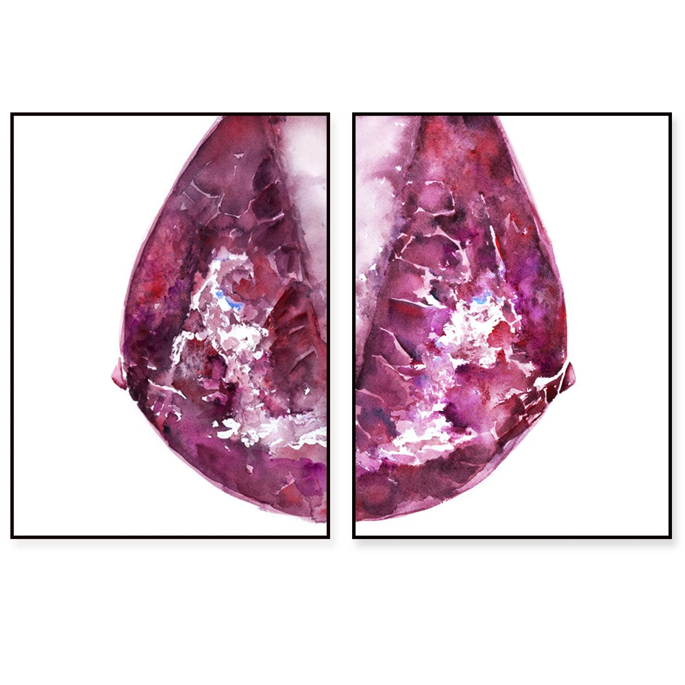 Watercolor Mammogram Art Print, Breast-Themed Artwork, Abstract Anatomical Style Decorative Canvas Poster, Gift for Doctors