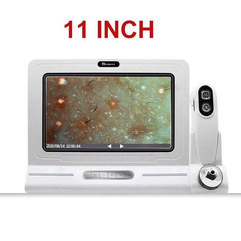 11 Inch Professional High Quality HD Hair Follicles Scalp Scanner Detector Hair Analyzer / Skin And Scalp Hair Analysis Machine
