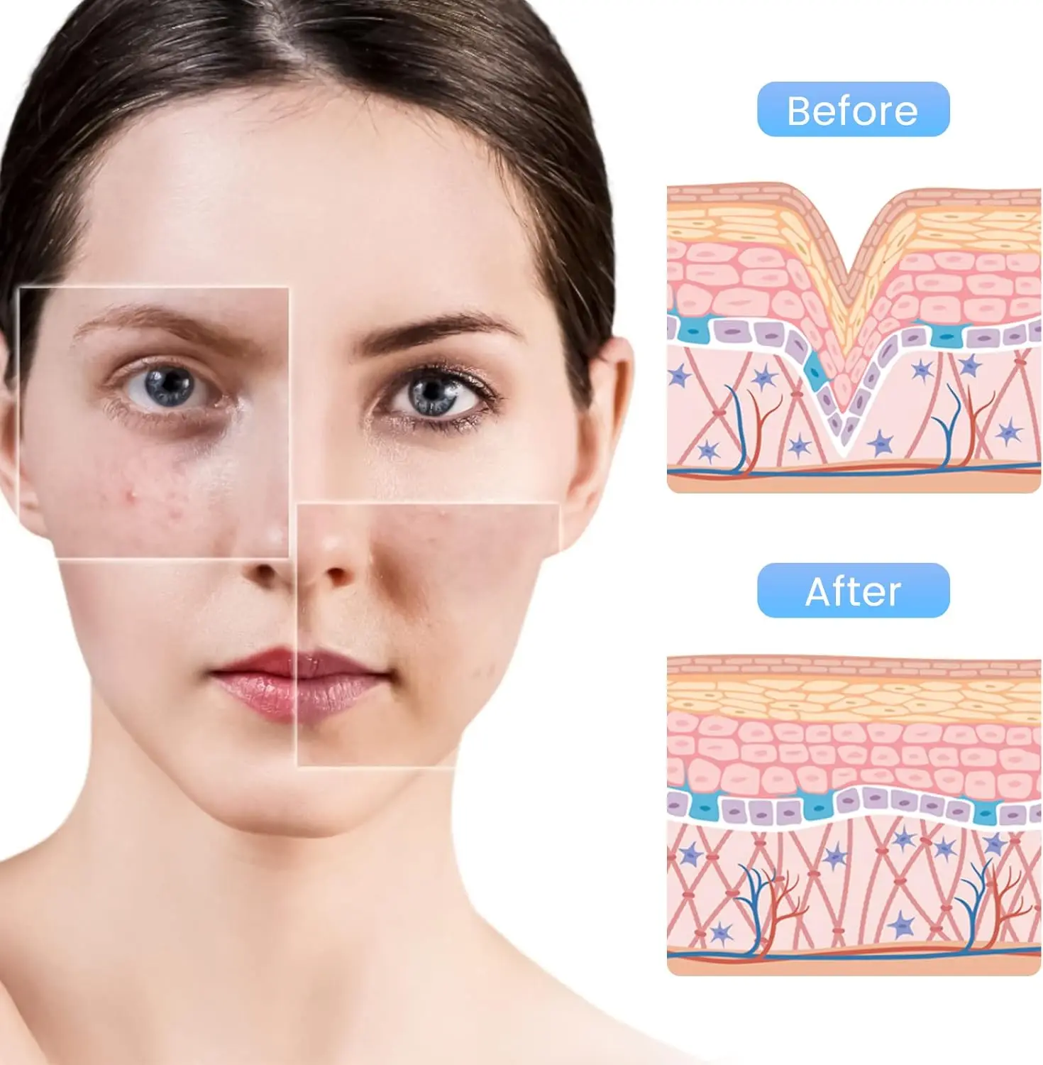 Dermapen M8S-Patronen, 12/36PIN Microneedling-Patronen für A8S M8S A9 A11, Einweg-Ersatz-Microneedling-Nadeln – Detail 5