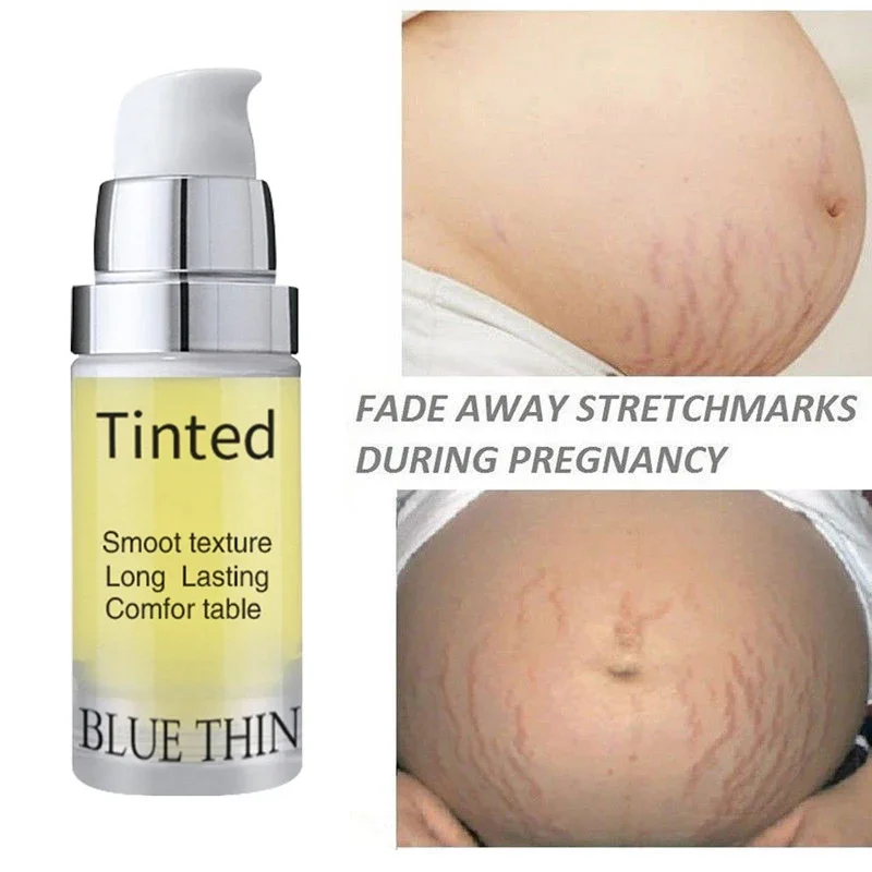 

10ml Repair Cream Removal Fade Stretch Marks Scar Obesity Pattern Growth Pattern Gel Nourishing Maternity Body Skin Care