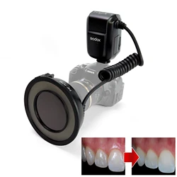 Dental Cross Polarization Set - Oral Photography - Godox MF-R76 Flash - Polar Eye - No Reflections, No Glare Photo For Dentist