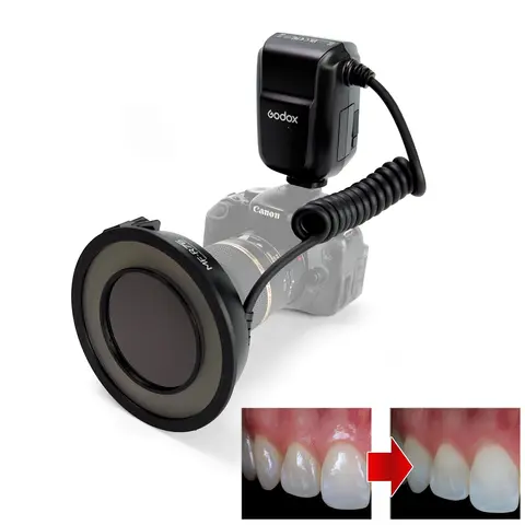Dental Cross Polarization Set - Oral Photography - Godox MF-R76 Flash - Polar Eye - No Reflections, No Glare Photo For Dentist