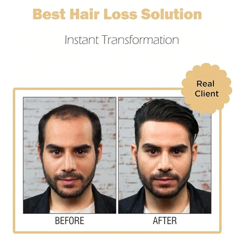 Imagen 2 del producto 100% cabello humano para hombres, prótesis capilar de encaje, peluca Natural en blanco, se puede hacer en cualquier peinado, peluquín, peluquín suave