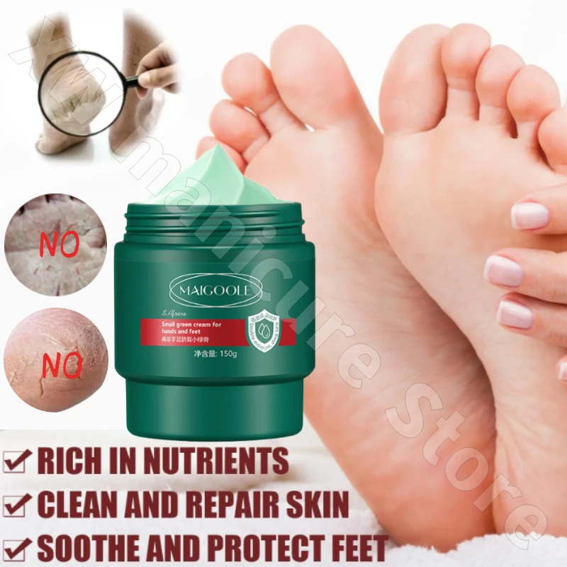 

South African Anti-Cracked Foot Cream Moisturizing Anti-Frostbite Cracked Improvement Rough Hands and Feet Cracked Cream 150G