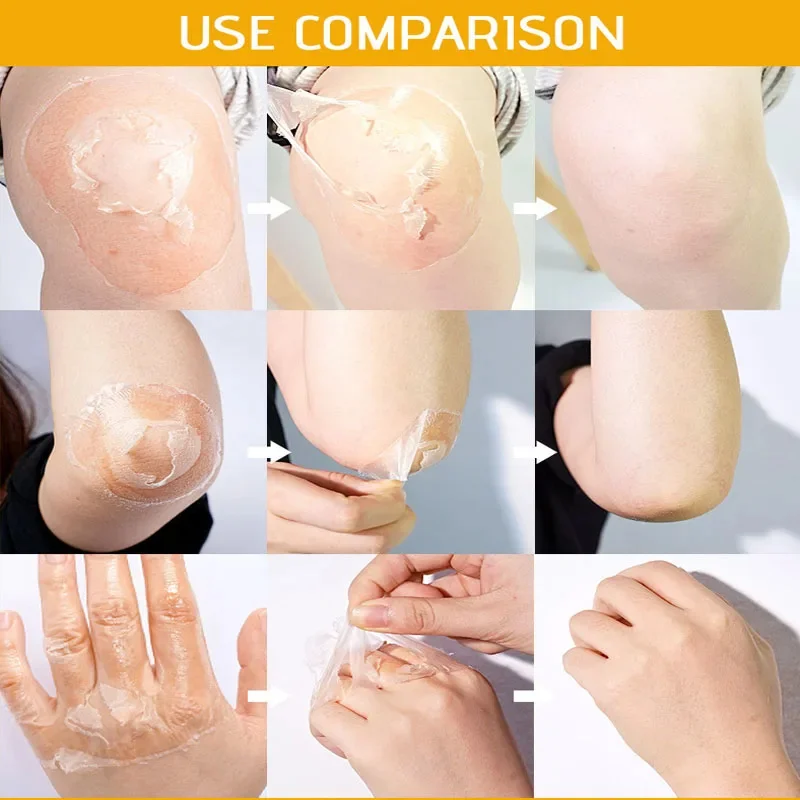 Gelbes Peeling-Lotionöl, 100 % organisches Bleichen, Peeling für dunkle Haut, Aufhellung, nährende Hyaluronsäure, feuchtigkeitsspendende