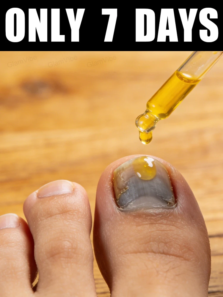 

2026 Limited Offer! Free Shipping! Tea Tree Nail Solution 10ml