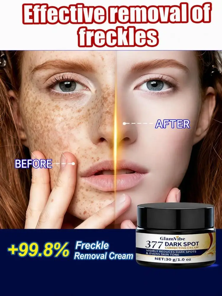 Facial Brightening Cream with 377, Helps Reduce The Look of Dark Spots & Melasma, Even Out Skin Tone, Hydrate & Nourish Dull Skin, Non-sticky Daily Face Care Moisturizer