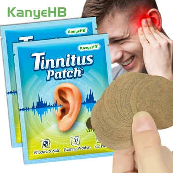 24 יחידות = 2 שקיות מדבקת טיפול בטיניטוס להגנה על אובדן שמיעה, הקלה על כאבי אוזן, תמצית צמחית לטיפוח הבריאות הרפואית A1025