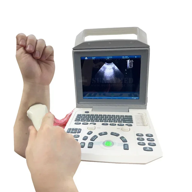 رخيصة ودقيقة SYA-150_Vet الرقمية البيطرية الحيوانات الأليفة الماسح الضوئي بالموجات فوق الصوتية سعر عربة المحمولة الحيوان الطبيب البيطري الموجات فوق الصوتية المبيعات الساخنة