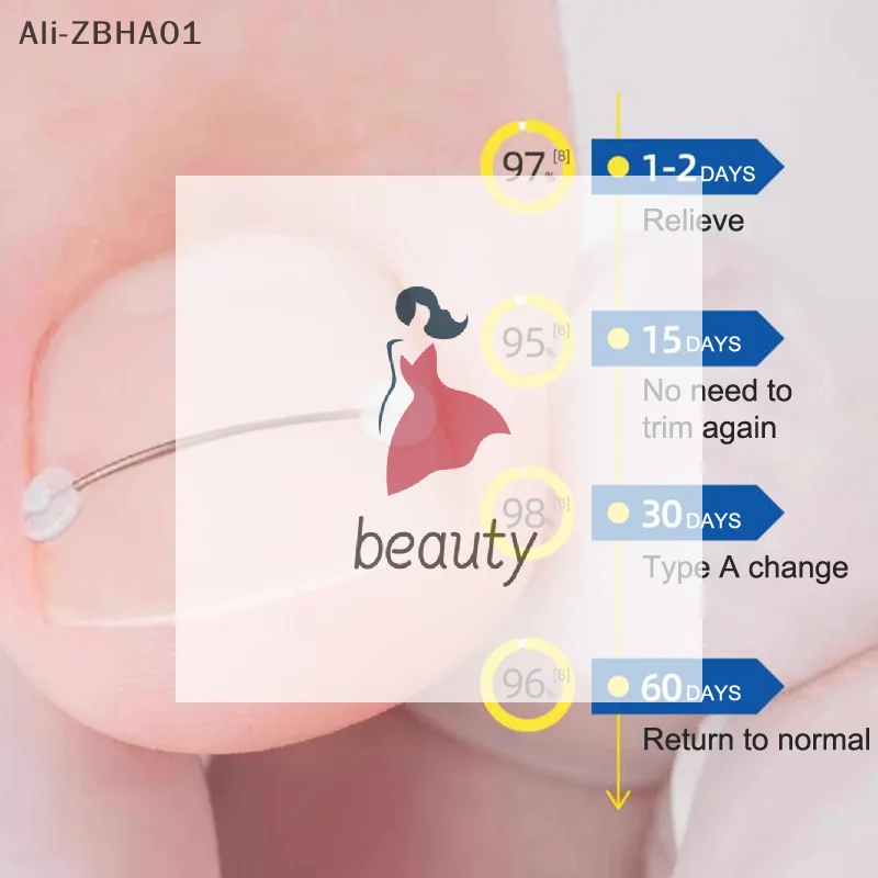 نام استقامة كليب هدفين باديكير أداة تو مسمار العلاج رقعة مرنة ملصق نام أظافر تصحيح أداة