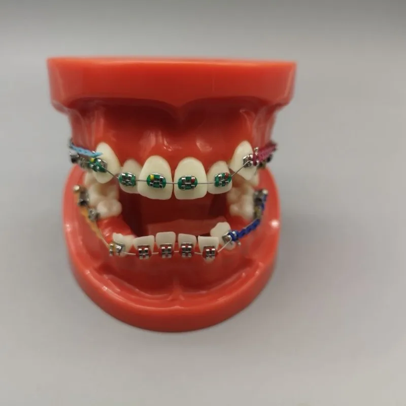 Lab Metal Malocclusion Orthodontics Model, Bracket Paste Ligation Pull Support Nail Process