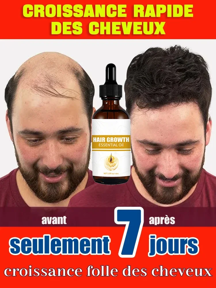 Hot sale, buyers will buy again, hair is getting more and more, say goodbye to baldness, sparse hair starts to become thick