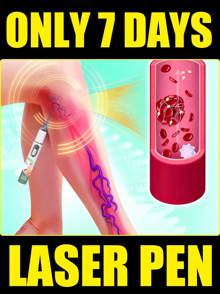 

Leg care tools eliminate spider leg varicose veins Vein blue light tool, Athletic Performance and Recovery