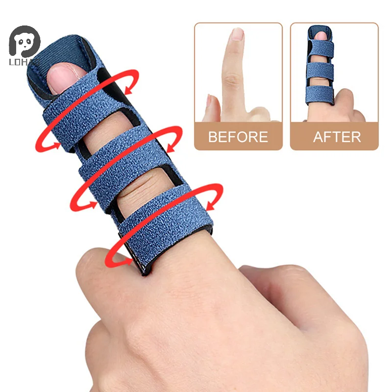 指スプリント矯正サポート、痛み緩和、トリガーフィンガー固定スプリント、矯正ブレース、調整可能、捻挫、脱臼、骨折用
