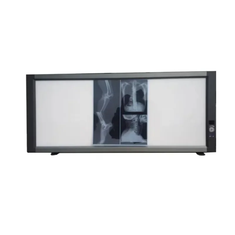 Ultra slim LED 2 bank LED de ntal negatoscope medical X ray film viewer with CE with ISO13485 with three years warranty