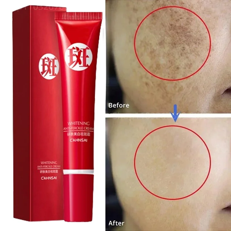 New Effective Whiten Cream Brighten Face For Face Spots Remove Dark Spot Melasma Anti-pigmentation Improve Dullness Skin Care