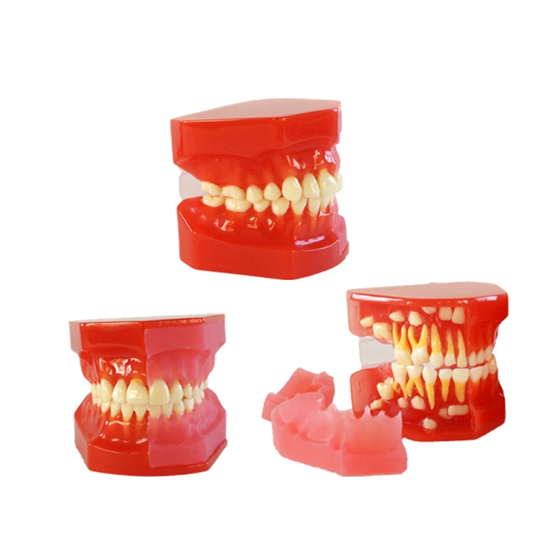 Dental Standard Teeth Model Orthodontic Teeth Model Dentist Educational Model Dental Materials Dental Model