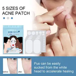 80pcs/set Large Size Acne Patch Acne Pimple Patch Face Treatment Remover Stickers Invisible Pimples Acne Blemish Tools