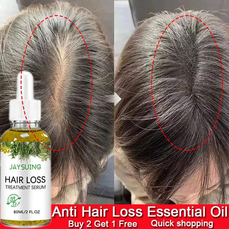 Fast Hair Growth Serum African Crazy Traction Alopecia Anti Hair Loss Essential Oil Prevent Baldness Scalp Repair Hair Care 60ml