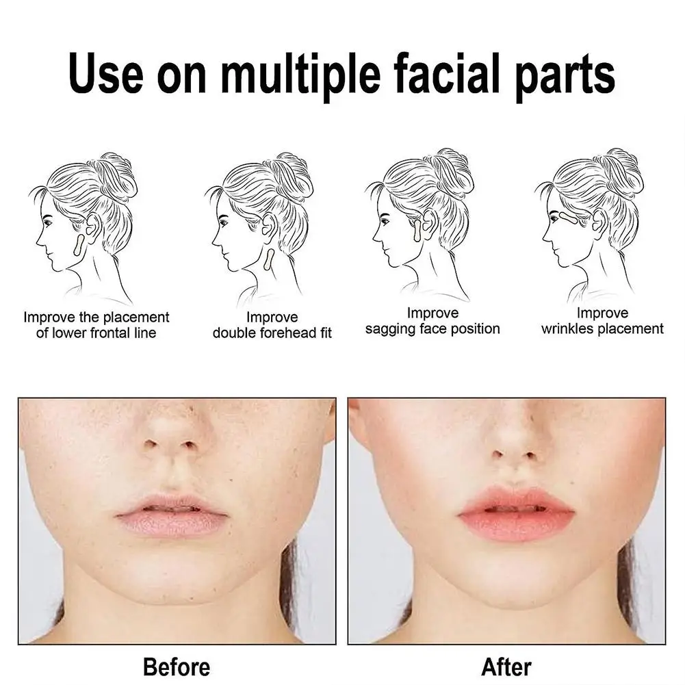 100 قطعة من ملصقات شد الوجه، أشرطة شد الوجه على شكل حرف V، ملصقات شفافة لشد الوجه #5