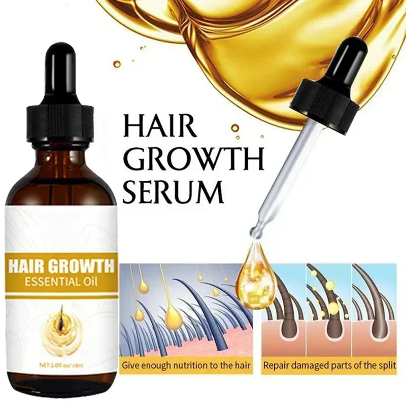 Fast Hair Growth Oil Effective Baldness Repair Hereditary Postpartum Hair Loss Seborrheic