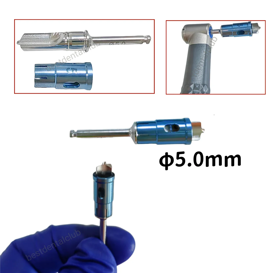 

1Piece Never Loss Bone Collector Drills Dental Stopper Self Bone Power Gain ∅5.0