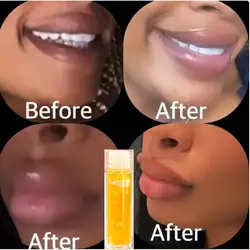 TURMERIC LEMON Lip Oil Dark Lips Remedy Lip Lightening Cream Balm for Lightening & Brightening Dark Lips Pink Lips Cream