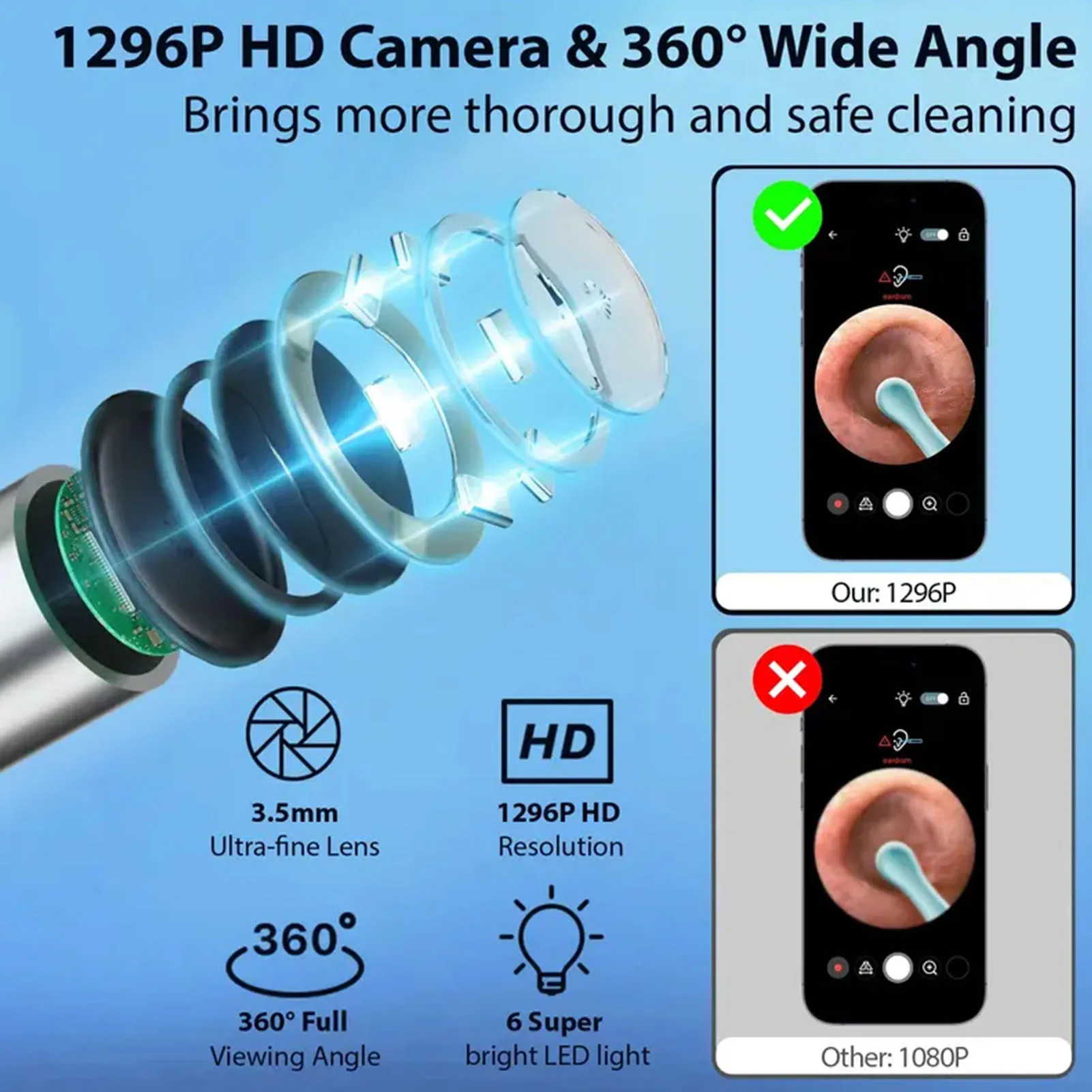 

Очиститель ушных каналов Набор для чистки ушей для телефонов Android Белый очиститель ушных каналов с камерой 1296P 5 ушных ложок Средство для удаления ушной серы