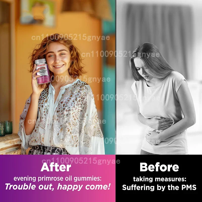 زيت زهرة الربيع المسائي يعزز صحة المرأة 1000 ملغ زيت زهرة الربيع المسائي المضاد للتجاعيد ومضاد للشيخوخة البشرة الغذائية #4