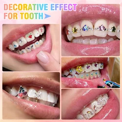 1Set Dental Tooth Gems Crystal Diamond Ornament Diy Tools Various Shapes Color Teeth Jewelry Denture Acrylic