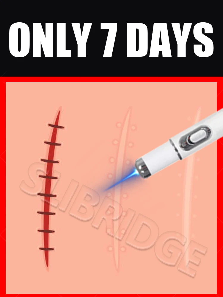 

2025 hot sale,blue light pen solve scar,scar care tools, unisex