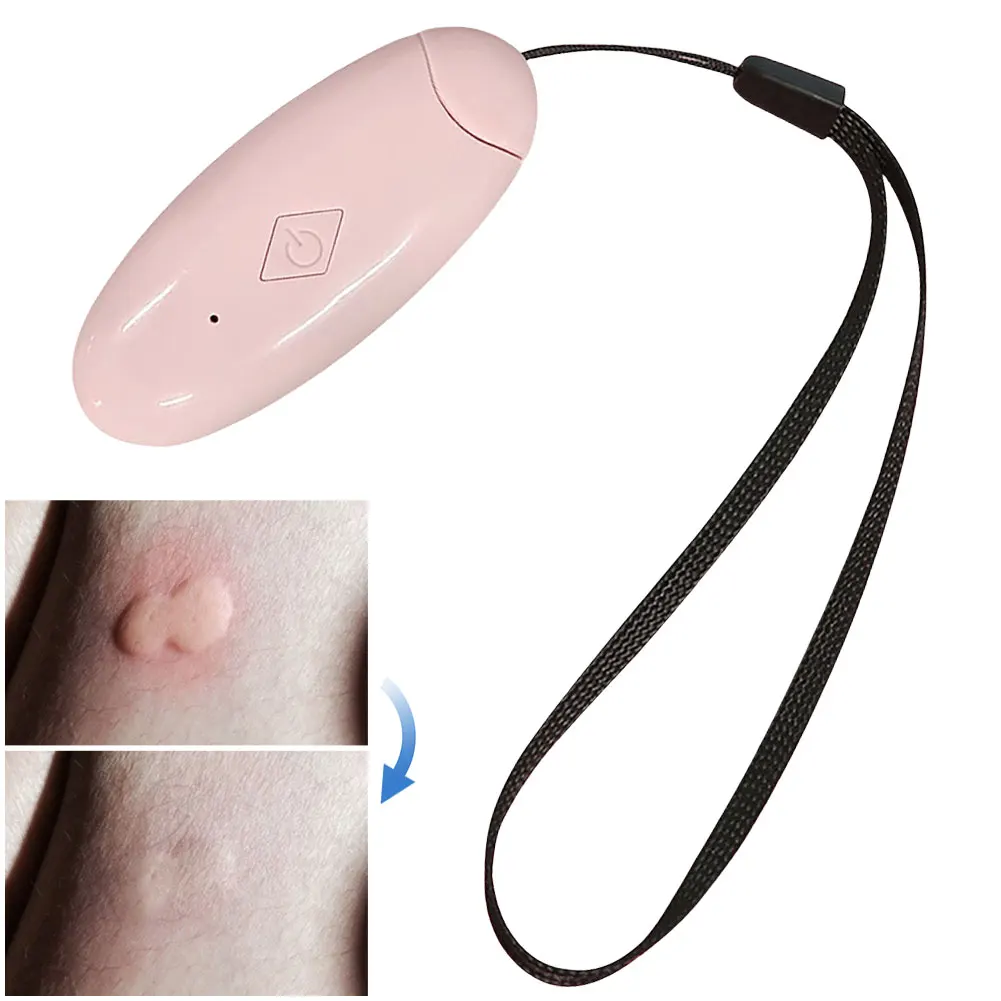 Portable Mosquito Insect Bite Relieve Itching Pen Natural Electric Insect Bite Healer Chemical-Free for Camping Travel Outdoor