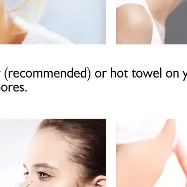 Electric Facial Skin Care Pore Removal Cleanser Vacuum Acne Removal For Deep Facial Pores 5 Suction Power Blackhead Remover Pore