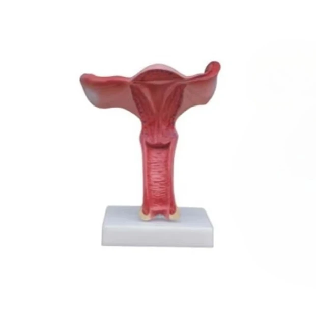 

Medical Science Uterus Enlargement Training Model Magnified Uterus Model for Teaching