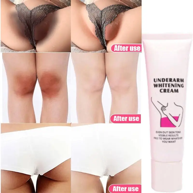 Whitening Cream Private Parts Whitening Cream  Arm Thigh Body Knees Whitening Brighten Skin Mild Non-irritating