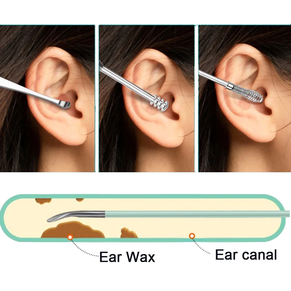 6pcs Ear Wax Removal Tool Ear Cleaner Spiral Rotating EarPicking Spoon Ear Picker Spoon For Cleaning Collecting Ear Wax